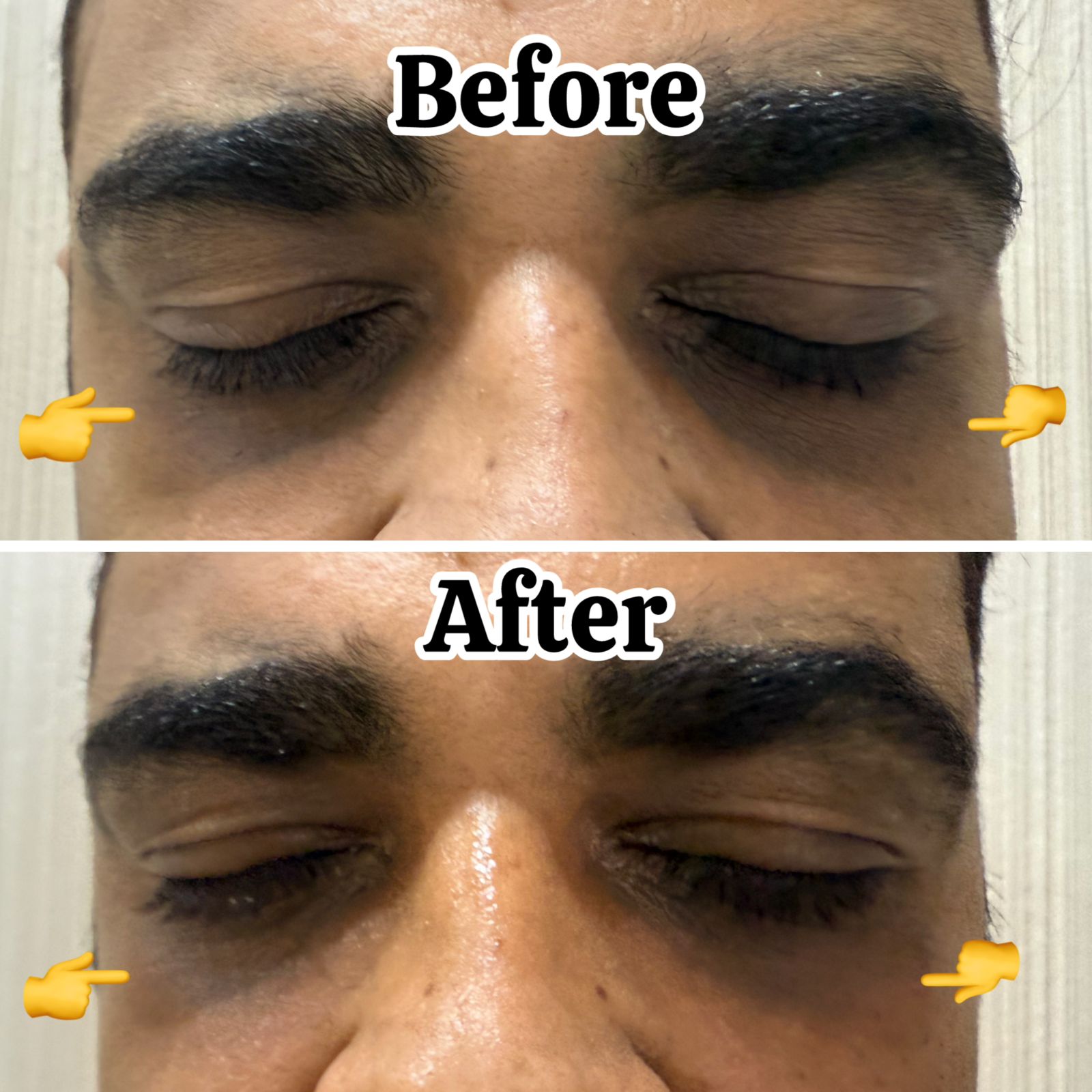 Dr. Nidhi Thacker treating a client using advanced medical laser